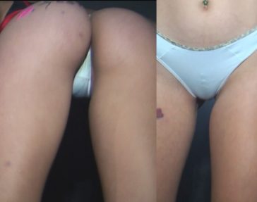 Dancing Like a Bitch At The Disco