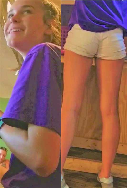 Beautiful Candid Teen In White Shorts