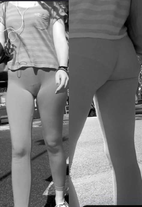 X Ray Candid Cameltoe