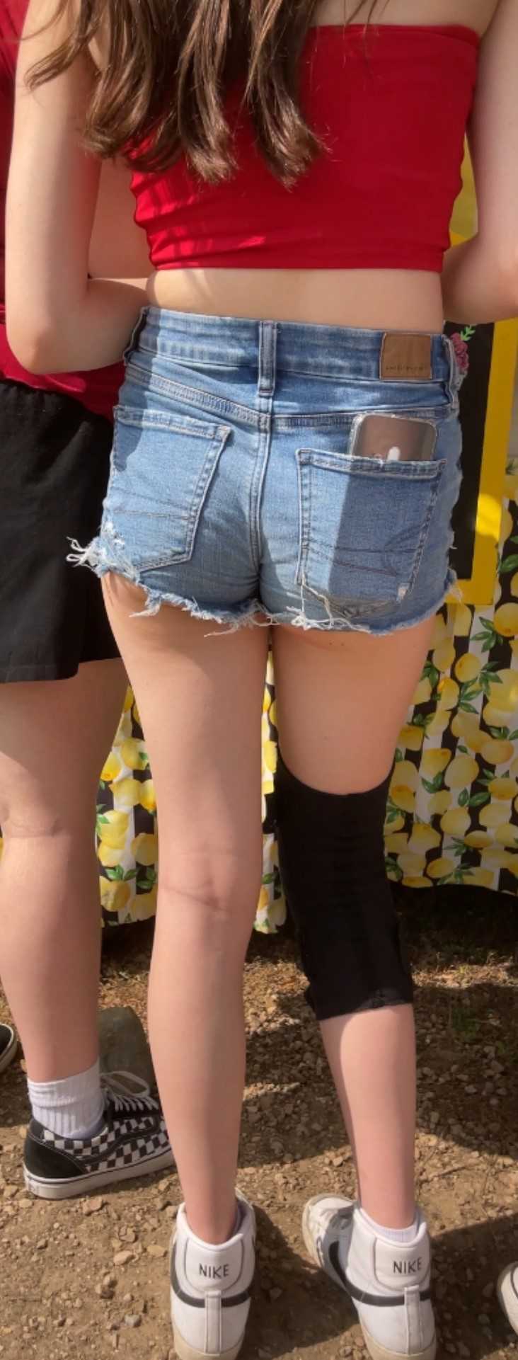 Injured Skinny JB Teen In Shorts