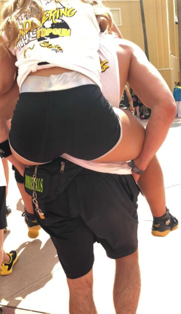 Black Shorts Teen Broke His Leg